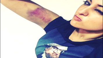 Check out: Sonakshi Sinha flaunts her bruised arm on the sets of Akira