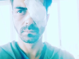 Arjun Rampal suffers an eye injury