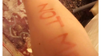 Shah Rukh Khan’s post on his surgery will prove why he is the wittiest actor in Bollywood