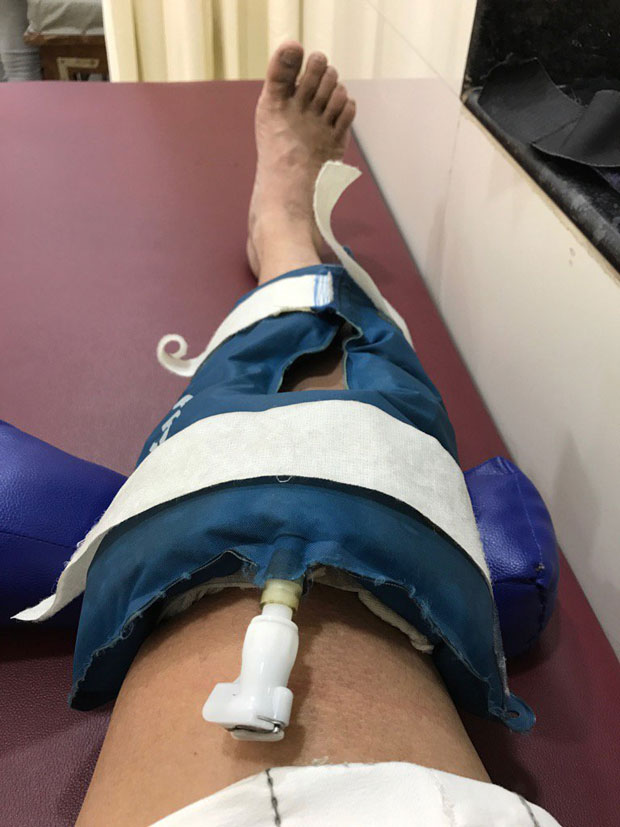 Arshad Warsi injures his leg during a dance sequence and here is what he said
