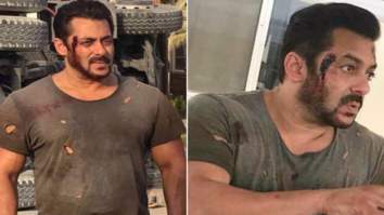 Tiger Zinda Hai: Salman Khan’s bruised look proves he is ready to enthrall the audience with breathtaking action sequences
