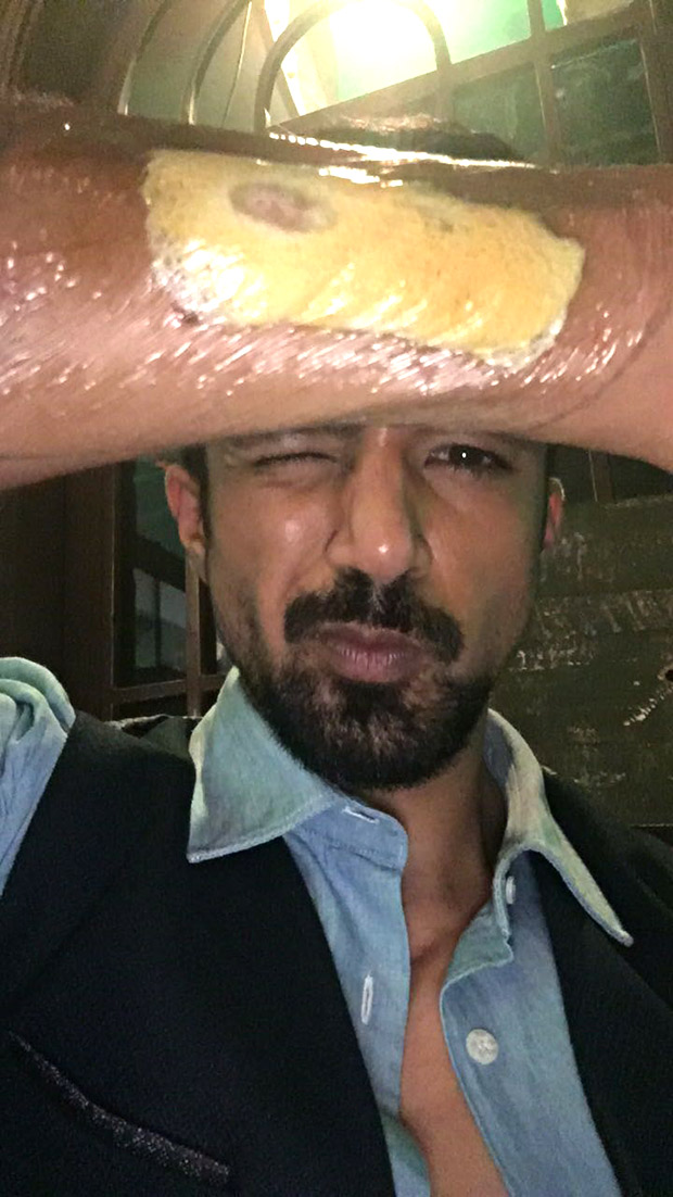 Saqib Saleem suffers injury on the sets of Race 3