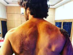 GUESS WHO? This actor gets BRUISED during battle sequence shoot