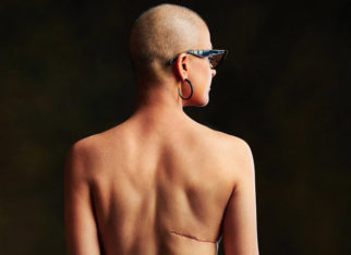 Tahira Kashyap Khurrana goes backless, proudly bears her scars in a powerful message on World Cancer Day
