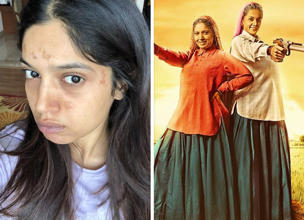 Bhumi Pednekar gets blisters on her face during the shoot of Saand Ki Aankh 