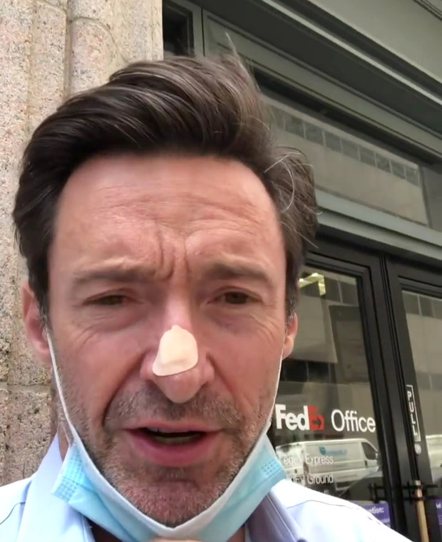 Hugh Jackman unergoes skin biopsy for possible cancer scare