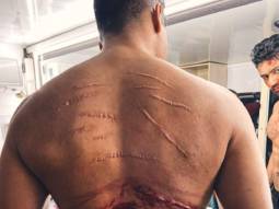 Vicky Kaushal shows his scars in behind-the-scenes photo from Sardar Udham