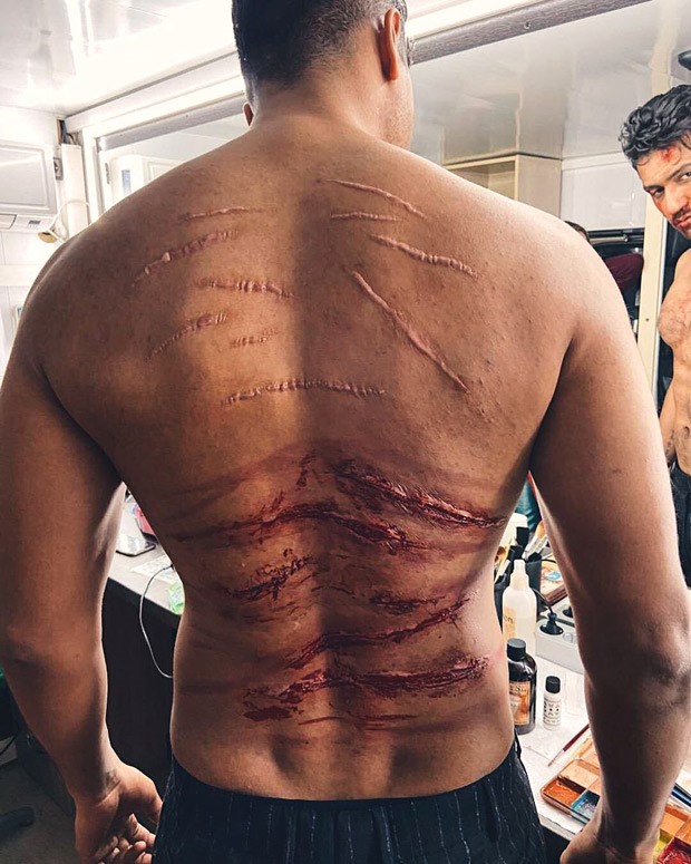 Vicky Kaushal shows his scars in behind-the-scenes photo from Sardar Udham