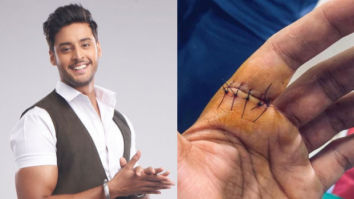 Shagun Pandey gets 6 stitches on this hand, showcases extreme dedication to work as he resumes shooting for his show  Meet