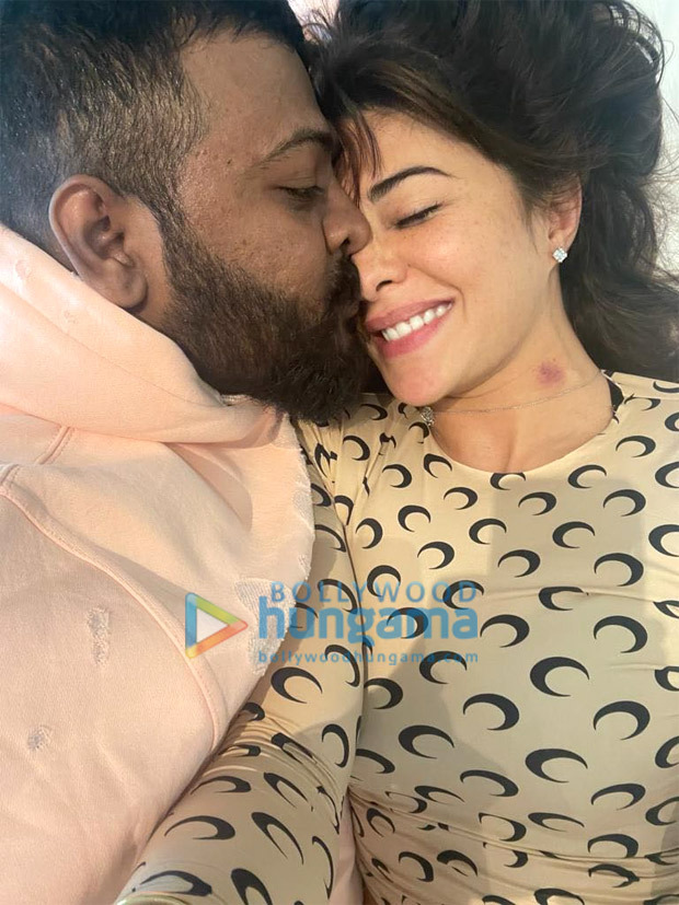 New photo Jacqueline Fernandez getting a kiss from conman Sukesh Chadrasekhar goes viral; people point out hickey in the picture 