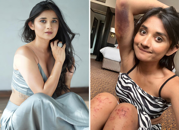 Khatron Ke Khiladi 12 contestant Kanika Mann gets bruised on the sets of the Rohit Shetty hosted show