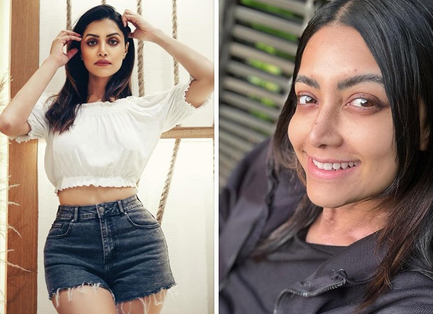 Jana Gana Mana actress Mamta Mohandas opens up about being diagnosed with Vitiligo : Bollywood News