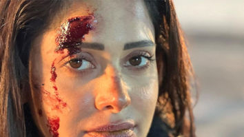Nushrratt Bharuccha shares wounded picture from the sets of Akelli; see post