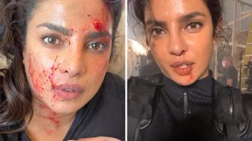 Priyanka Chopra says her ‘glamorous’ job involves blood, sweat and tears, shares a bloody and bruised video from Citadel set ahead of finale