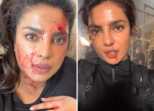 Priyanka Chopra says her 'glamorous' job involves blood, sweat and tears, shares a bloody and bruised video from Citadel set ahead of finale 