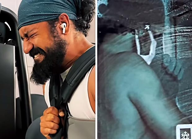 Vicky Kaushal hits the gym despite fractured arm; watch