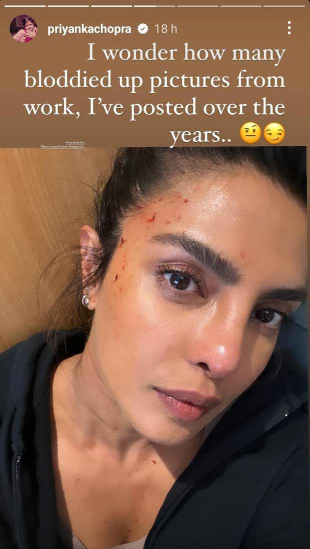Priyanka Chopra sustains minor injury on the sets of Heads of State; shares bloodied up picture