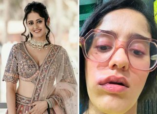 GHKKPM actress Ayesha Singh reveals ‘no accurate diagnosis’ for her face swelling; says, “I have connected with a third doctor, and yet we can’t pinpoint the root cause”