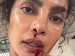 Action movies require blood & sweat, quiet literally & Priyanka Chopra proves it!