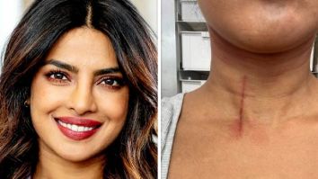 Priyanka Chopra Jonas gets injured on the sets of The Bluff; shares picture