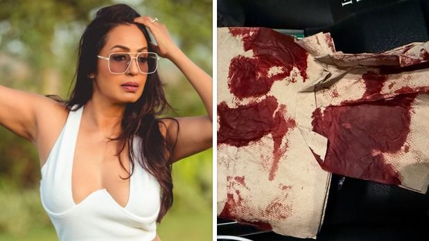 Kashmera Shah narrowly escapes “freak” accident in the USA, shares photo of blood-soaked tissue: “Kuch bada hone wala tha…”