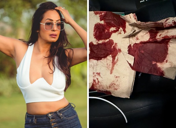 Kashmera Shah narrowly escapes “freak” accident in the USA, shares photos of blood-soaked tissue: “Kuch bada hone wala tha…”