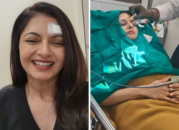 Bhagyashree gets 13 stitches on forehead after getting injured while playing pickleball