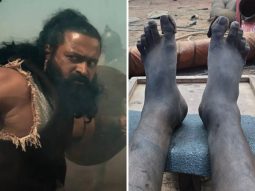 Rishab Shetty shares ‘swollen leg’ BTS photos from Kantara: The Legend Chapter 1; makes shocking revelation about painful climax