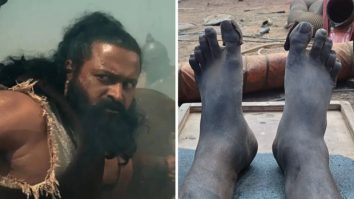 Rishab Shetty shares ‘swollen leg’ BTS photos from Kantara: The Legend Chapter 1; makes shocking revelation about painful climax