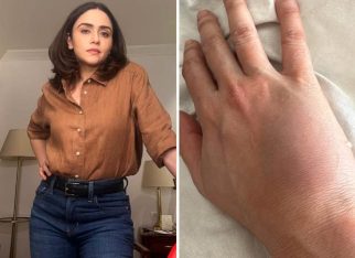Amruta Khanvilkar recalls injury during intense Taskaree action shoot: “My wrist remained swollen for over a month”